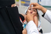 اليمن: ارتفاع مثير للقلق في حالات الحصبة والحصبة الألمانية، حسب منظمة الصحة العالمية