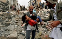 اليمن اختبار لإنسانيتنا