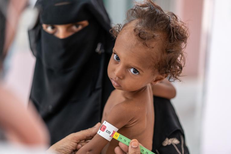 اليونيسيف: 10 آلاف طفل تعرضوا للقتل أو التشويه خلال النزاع في اليمن